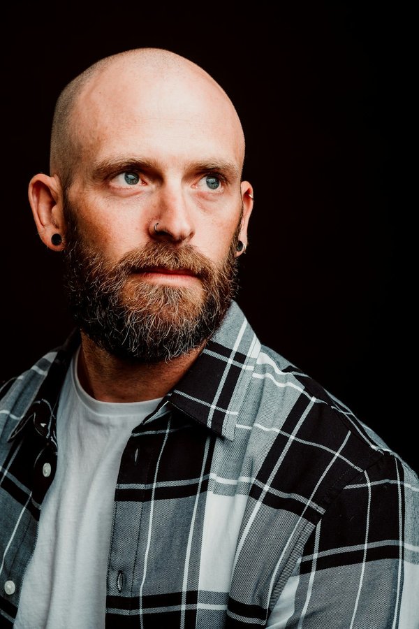 Vaincre le début de calvitie : Stratégies efficaces